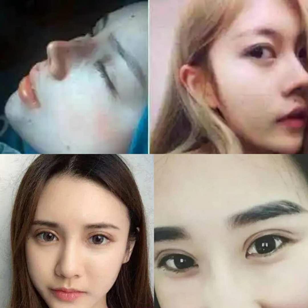 混血颜自测,五官混血的特征