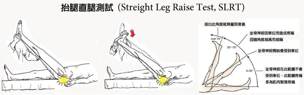 久坐后大腿肌肉酸疼使不上劲,久坐了腿部肌肉酸痛