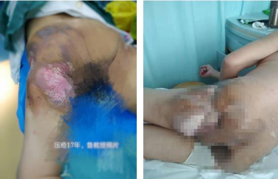 无精症患者的新希望,卵巢癌最新治疗新希望