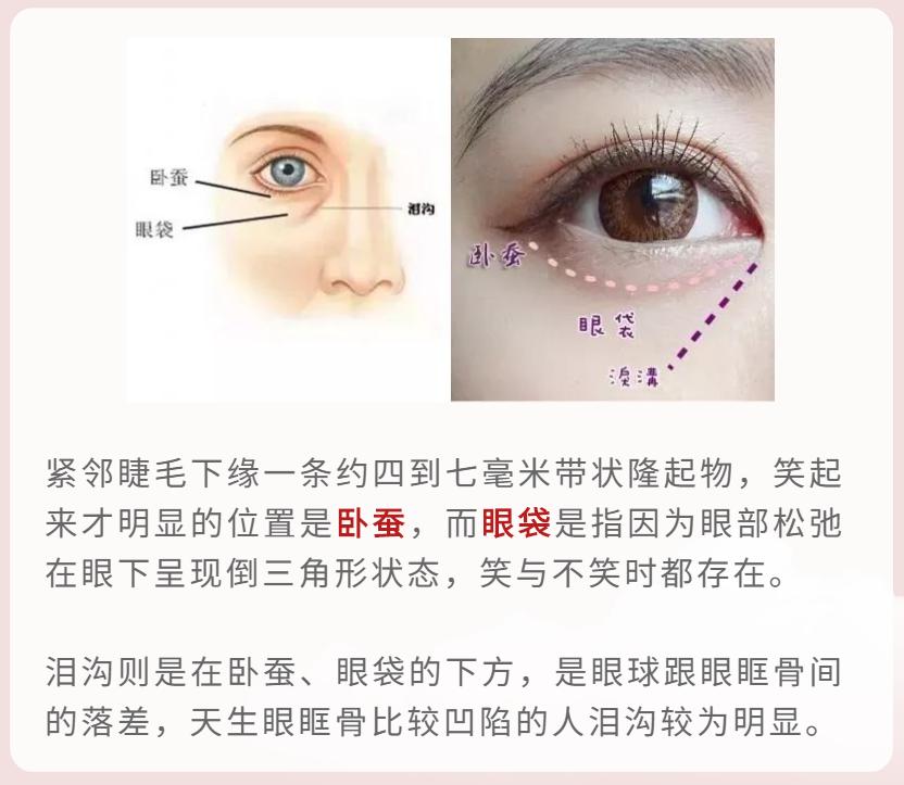 眼袋变卧蚕的按摩手法,三分钟改善大眼袋