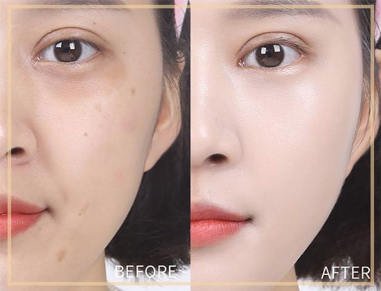 粉底液不服帖痘肌,粉底液不贴敷