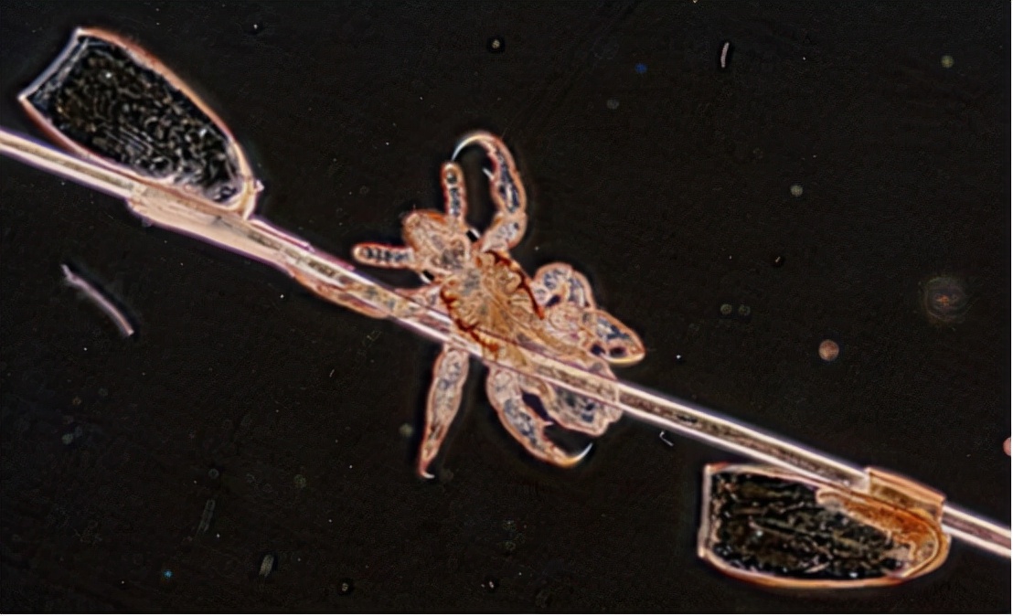 30年前的虱子现在怎么消失了,30年前人为什么都有虱子