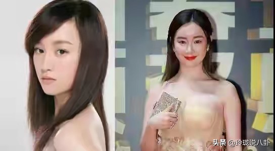 有哪些明星过度整容惨不忍睹,整容失败女明星今昔对比