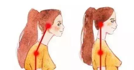 猥琐颈怎么矫正,一招改善猥琐肩