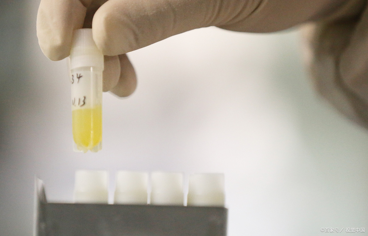 精子不液化和液化精子的区别,精子不液化和不完全液化有区别吗