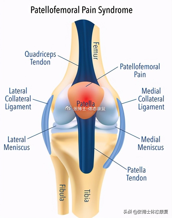 运动康复膝关节疼痛解决,下髌骨关节疼痛综合征