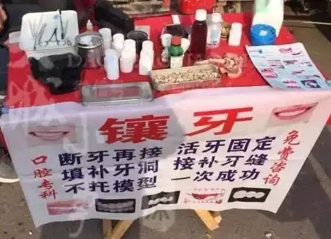 看牙又贵又遭罪,看牙那么贵没人管吗