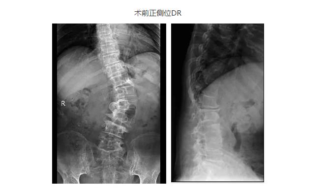 山东省文登整骨医院外科门诊,山东文登整骨医院病房
