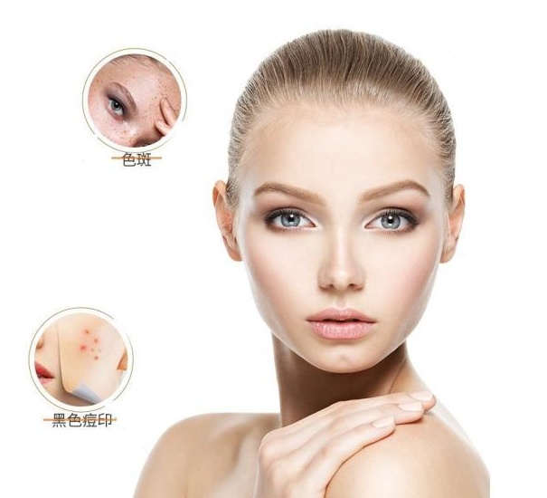 怎么美白淡斑最有效方法,美白淡斑最简单的方法