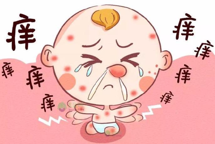2个月宝宝脸上长湿疹热疹怎么办,满月婴儿脸上起红疹是湿疹吗