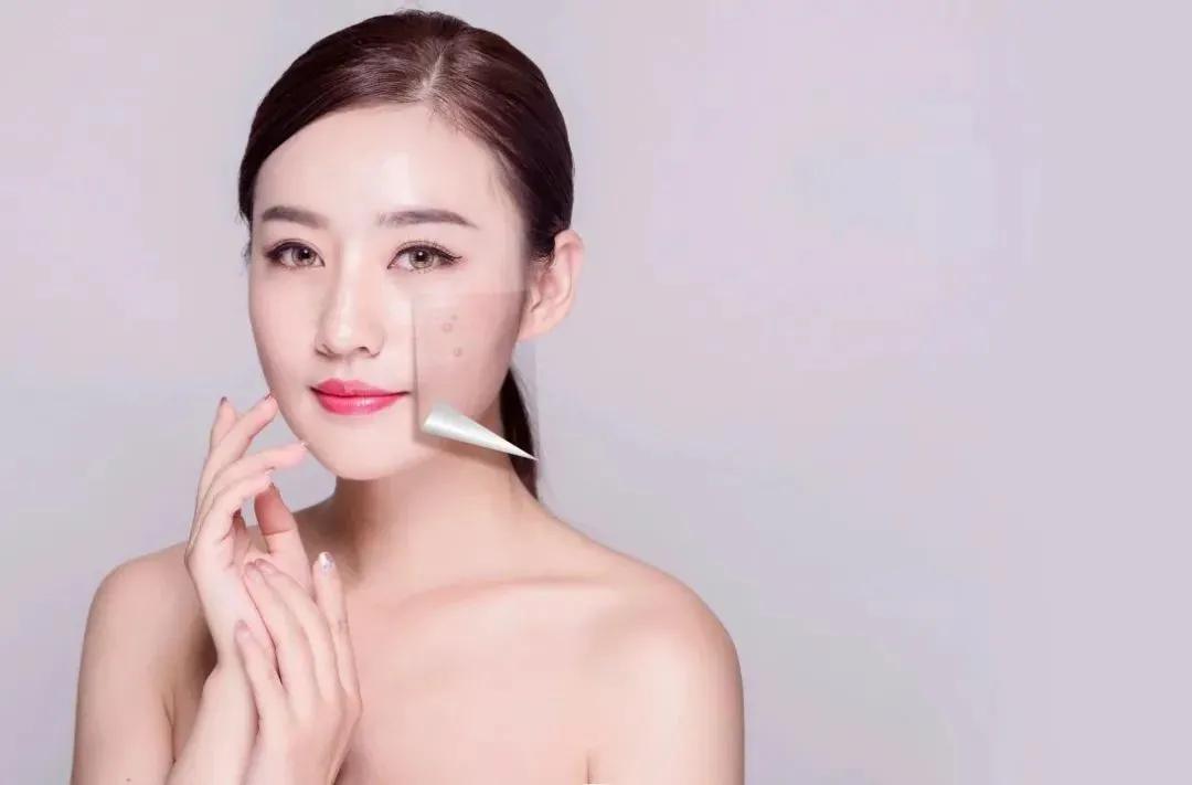 果酸换肤术后护理,果酸换肤没有注意防晒会怎么样