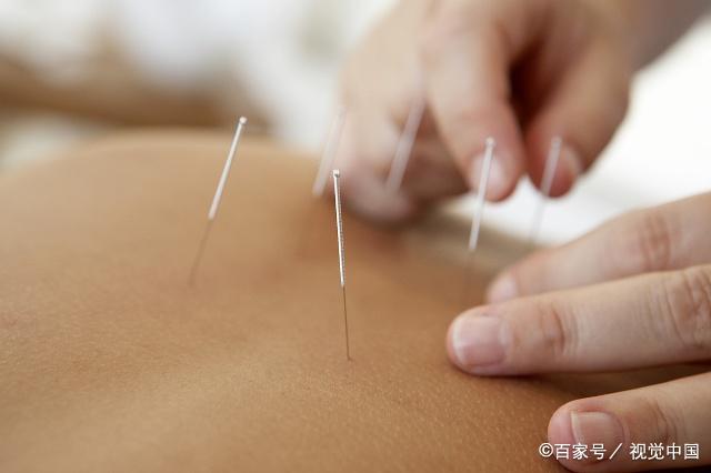 女子针灸治疗颈椎疼痛，没想到居然扎破了肺