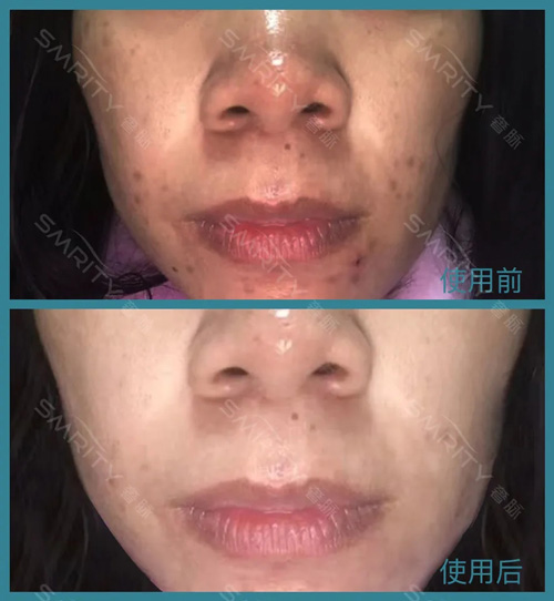 35岁女人脸部保养做哪些,女人皮肤暗沉该怎么保养