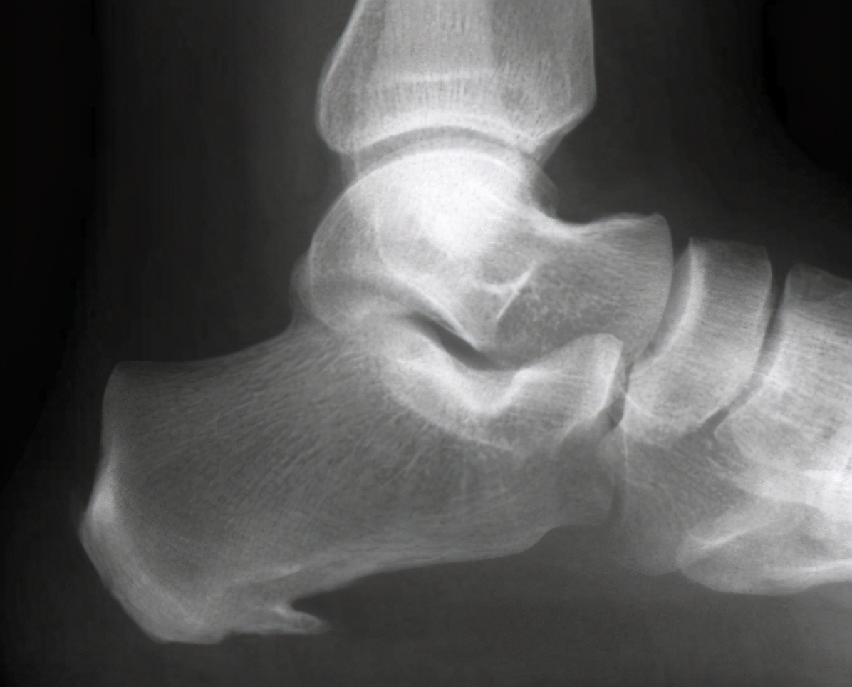 医生告诉你不用治的6种病,医生查出这6种病根本不用治