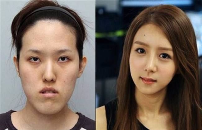 巴西男芭比娃娃,巴西整容狂人芭比娃娃