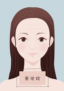 有哪些方法能有效改善法令纹,改善法令纹最好的方法真实有效