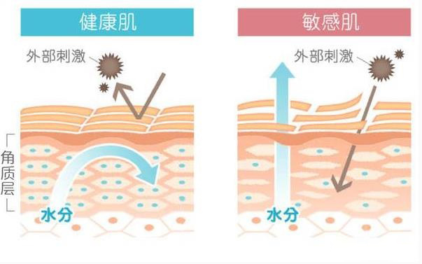 皮肤敏感肌全脸干脱皮,脸部泛红刺痛脱皮敏感肌怎么保湿