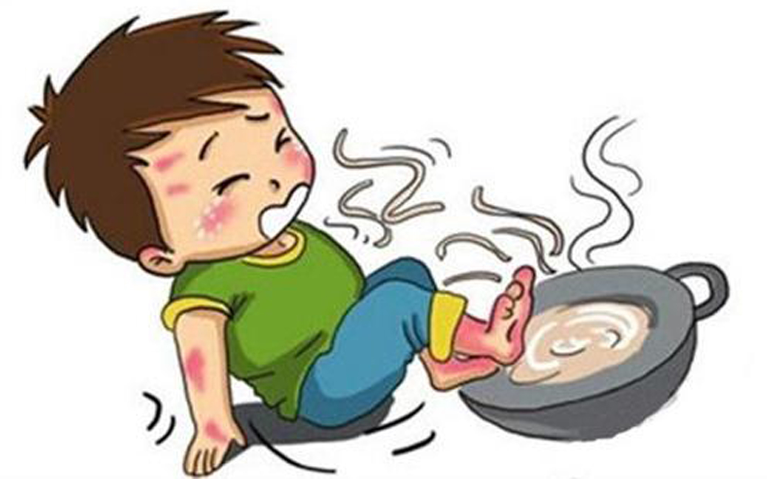 疫情期间儿童发烧怎么自救,儿童烧烫伤的早期防护及急救措施