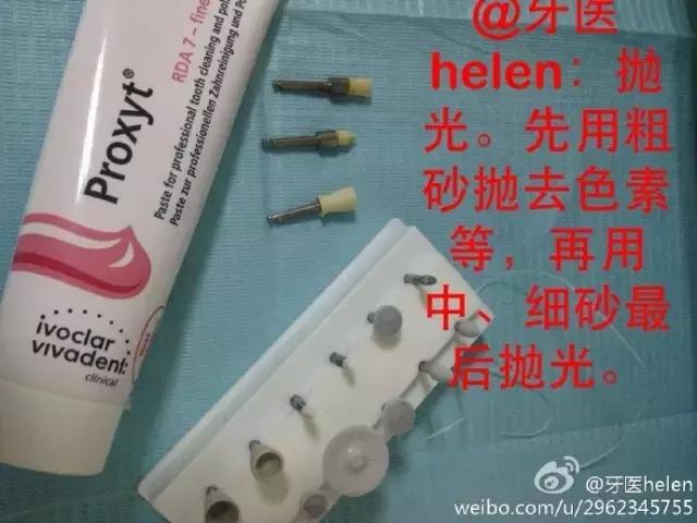 Helen齿科中心——超声波洁牙