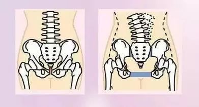 束缚带产后一个月用还有效果吗,束缚带顺产需要用吗