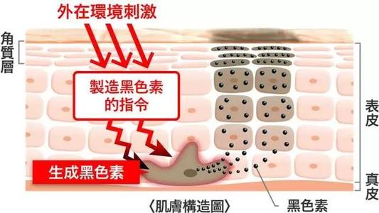 美白精华传明酸,美白传明酸