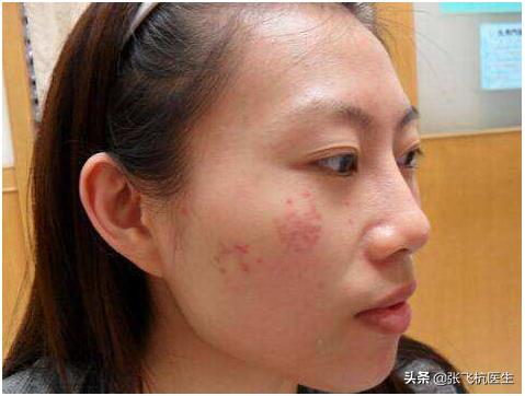 经常吃哪些食物能淡黄褐斑,黑褐斑的克星食物