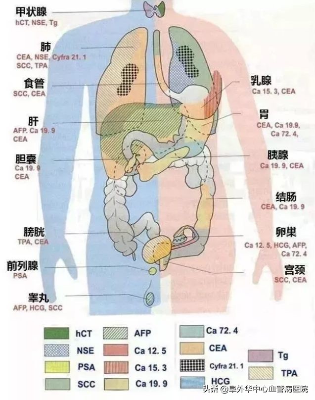 肿瘤标志物升高你是不是被吓到了,肿瘤标志物ca125单项升高意义不大