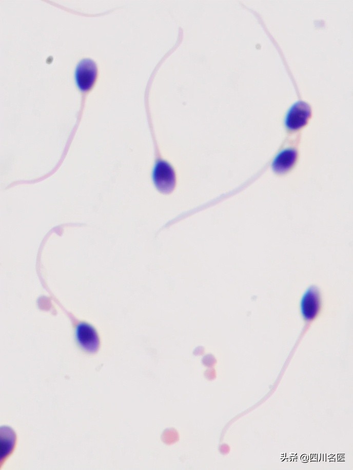精子是如何产生的百科,精子是不是每天都能生成