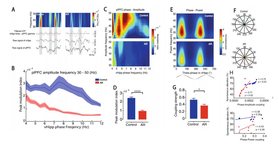 过敏性鼻炎对嗅觉的影响,过敏性鼻炎的后遗症怎么治