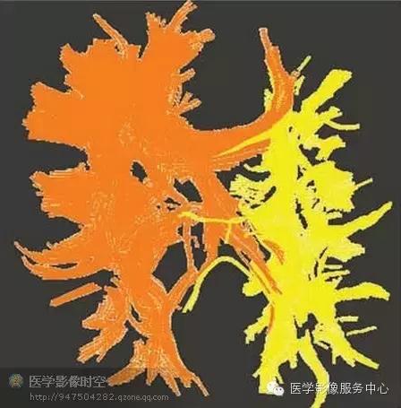 儿童癫痫CT表现,儿童各类癫痫脑电图特征