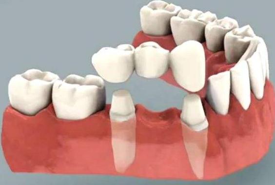 4种原因需警惕,哪些因素影响牙体色彩变化