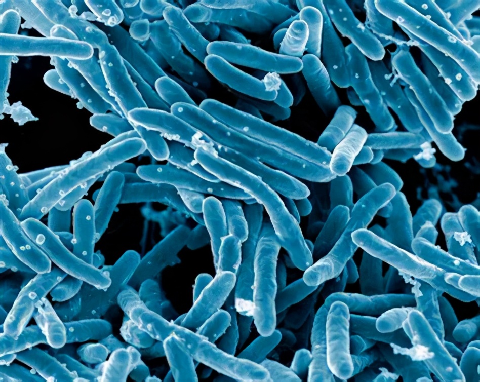 咳嗽半个月去医院做ct确诊肺结核,怀疑得了肺结核去哪里就诊