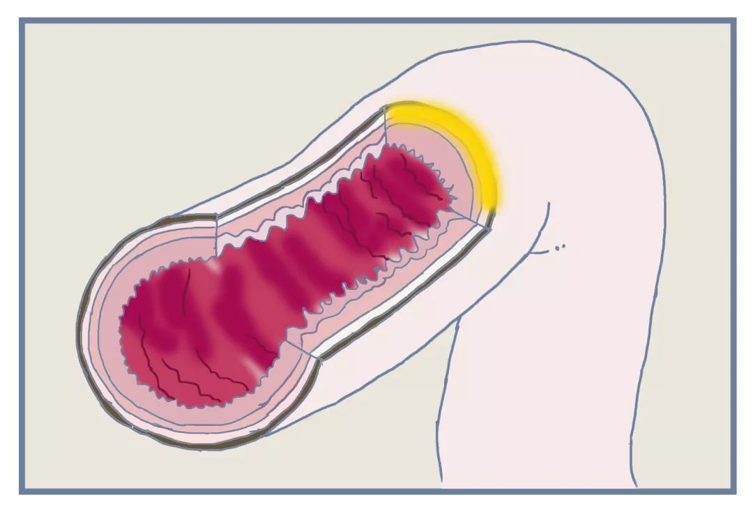 便秘在药店推荐的药品,大家都在用什么药治疗便秘