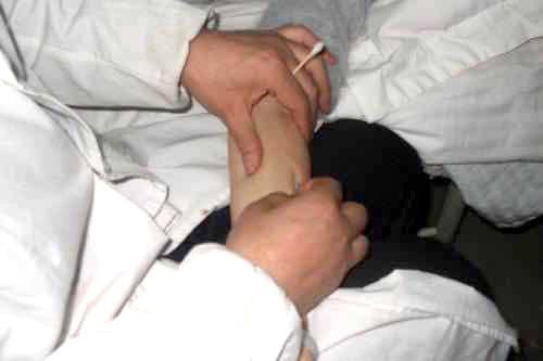 网球肘的预防保健注意事项有哪些,受凉引起的网球肘最快治愈方法