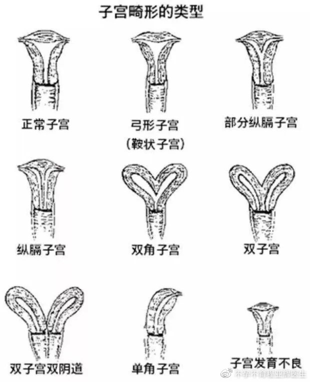 子宫畸形怀孕后对胎儿的危害,子宫畸形还能排卵吗