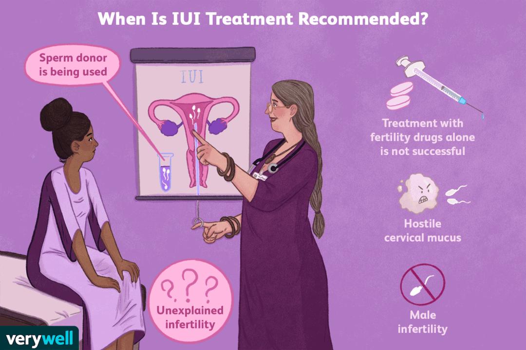 放开冻卵试管婴儿的限制啥意思,试管婴儿单身女性可以做吗