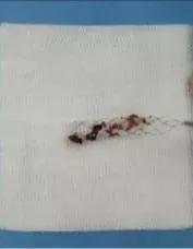 26岁小伙熬夜加班,23岁小伙熬夜突然头痛