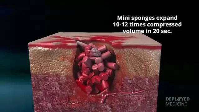 突破传统止血局限：美军战场止血利器X-stat