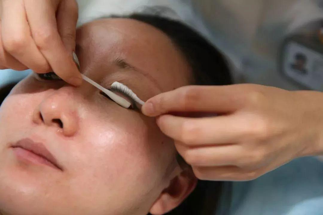 慢性卡他性结膜炎是什么结膜炎,春季卡他性结膜炎最新治疗方法