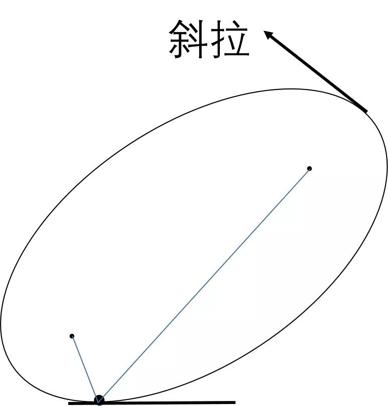 声波消除结石,超声波击碎肾结石有危害吗
