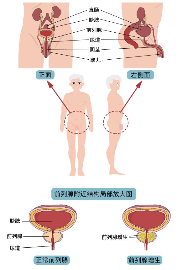 一文读懂痛风,一文读懂类风湿