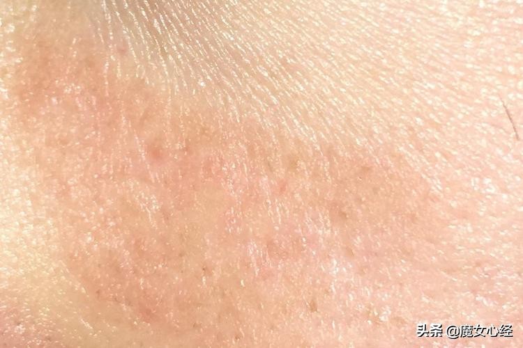 这样使用A醇产品，既能抗皱淡纹，又不伤害皮肤