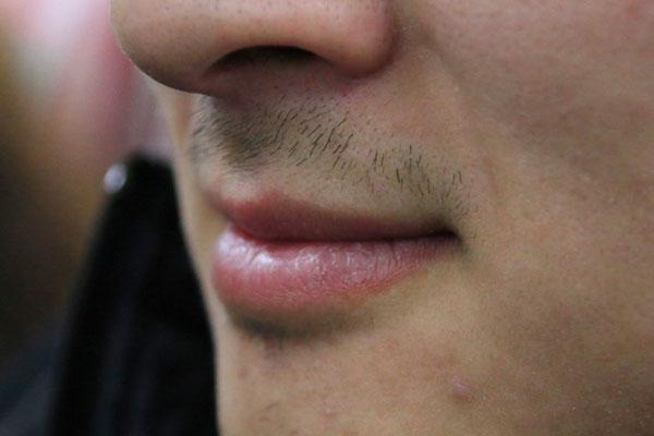 口腔有异味口臭怎么去除,口腔有异味怎么解决口臭