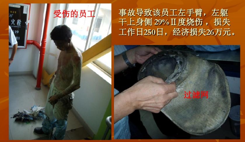 法兰之间为什么要加静电跨接,法兰静电跨接可以连接两个螺杆嘛