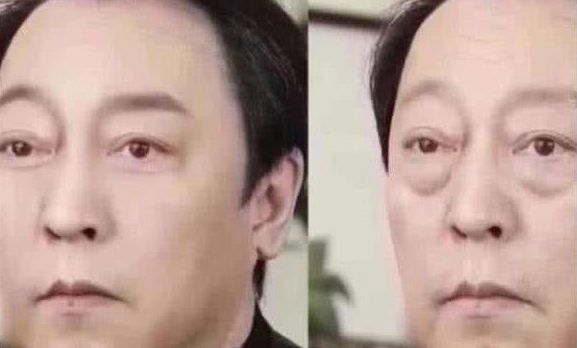 艾灸1小时,迅速提升下垂脸!简简单单就变美