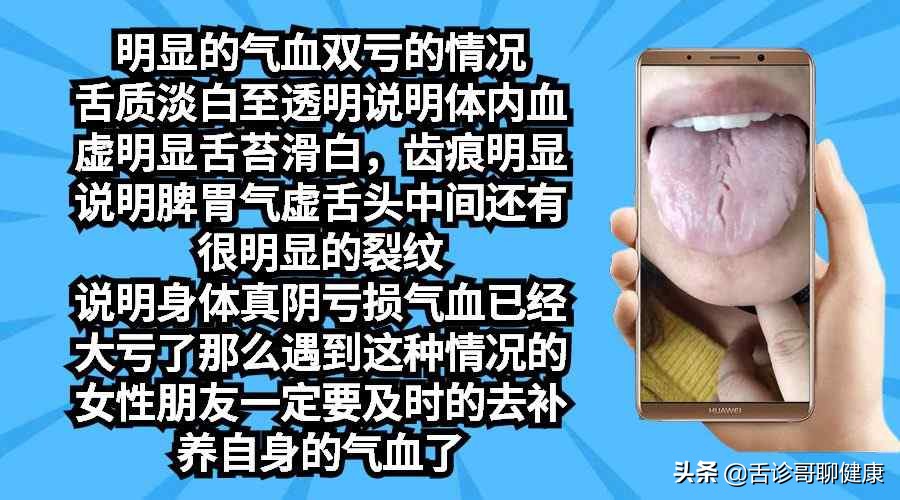 最实用舌诊图解专家总结六大舌象,零基础学舌诊气郁体质典型舌象