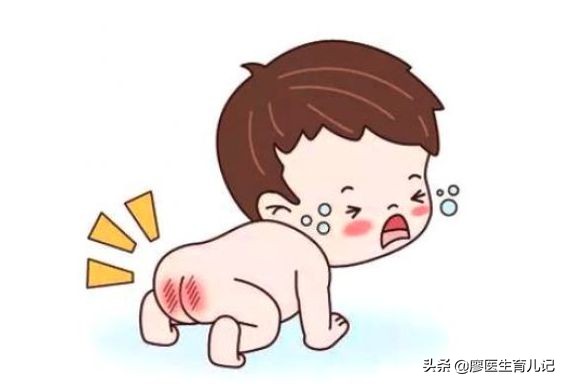 宝宝红屁股怎么办具体护理方法,宝宝红屁股了怎么好得快