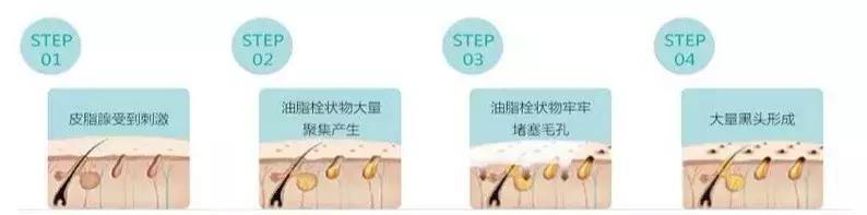 清理黑头的正确方法,黑头清理的简单正确方法