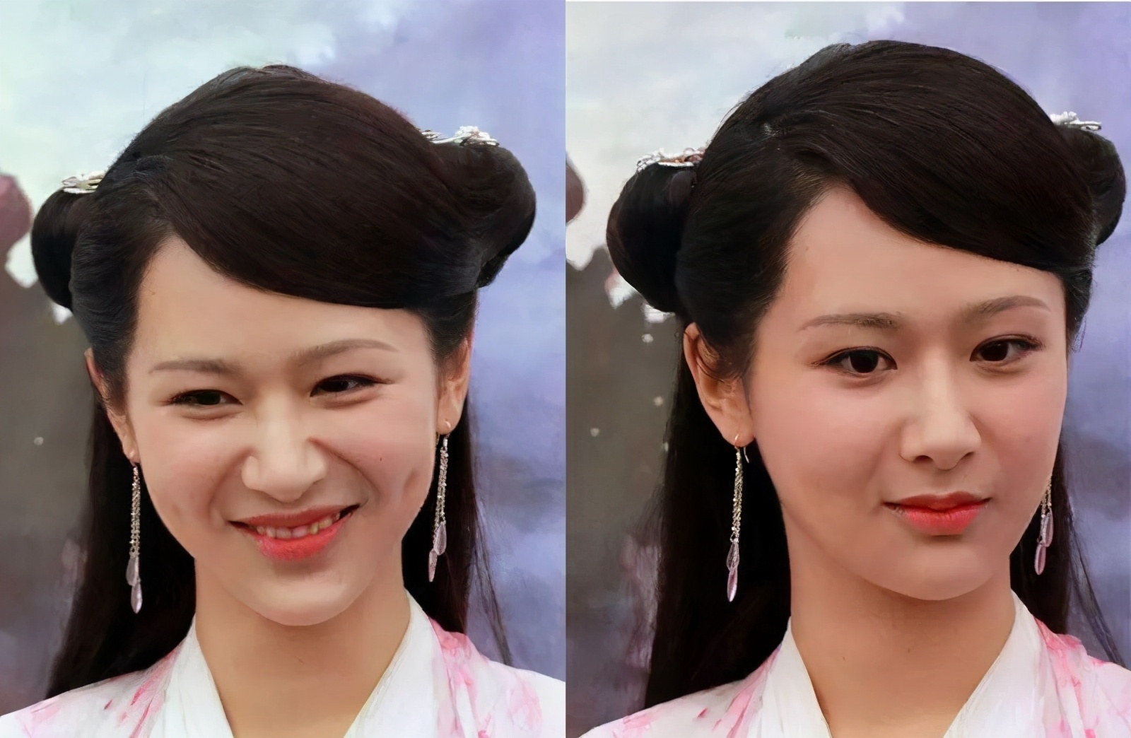 法令纹显老是什么原因,你比同龄人看起来老的原因是什么