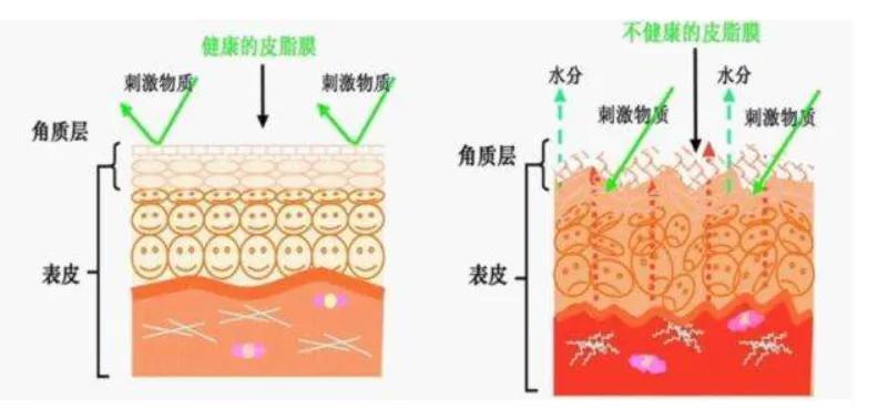皮肤自我修复能力差,怎么提升皮肤的自我修复能力